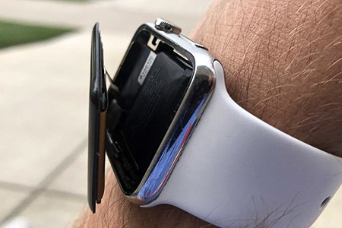 Pin Apple Watch phồng làm phù màn hình