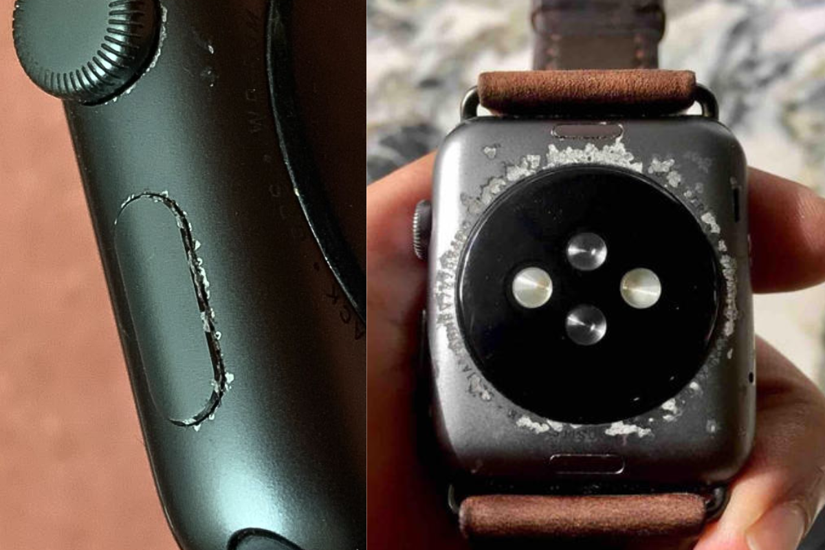 Vỏ Apple Watch bị trầy xước gây mất thẩm mỹ