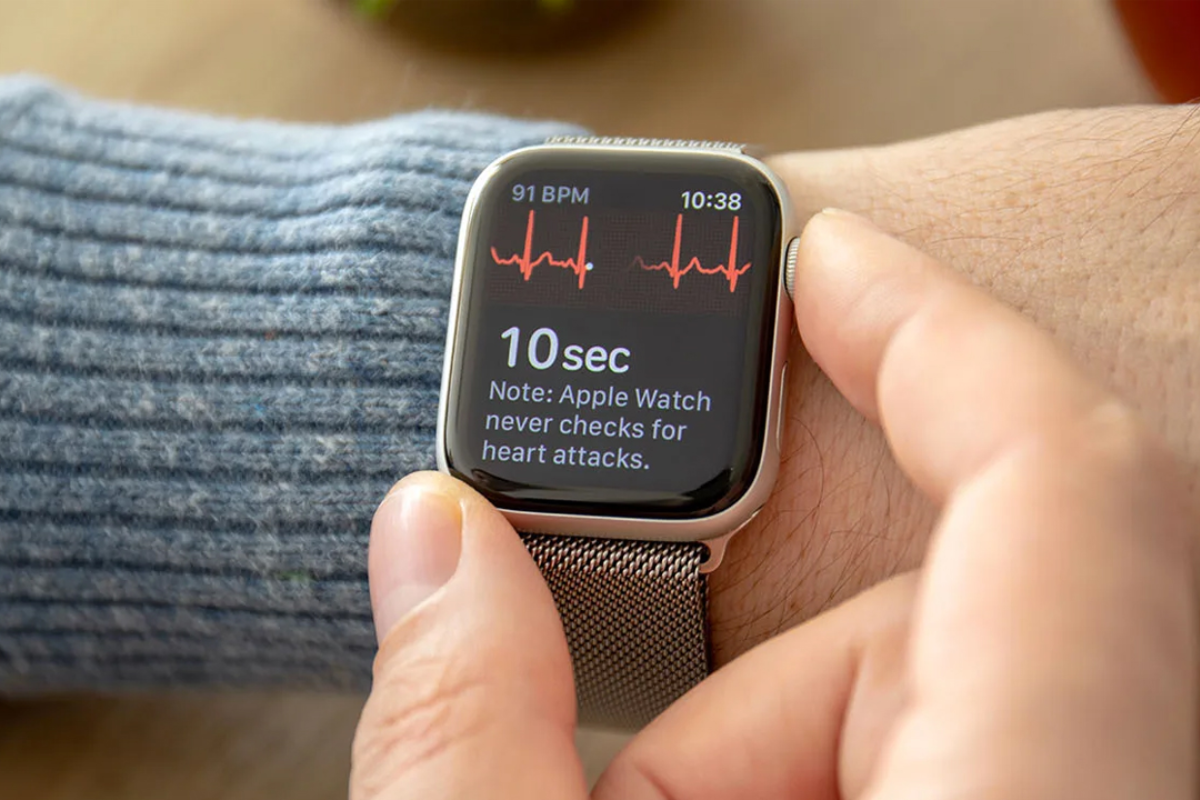 Tính năng đo điện tâm đồ trên Apple Watch S5